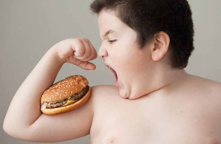 Ожирение у детей. Что такое, причины и лечение