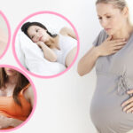 Что делать, если мучает изжога во время беременности?