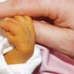 Желтушка у новорожденных, причины и лечение
